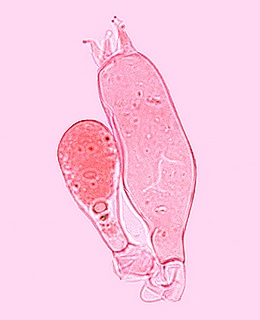 Lactarius subumbonatus cistidi e basidi